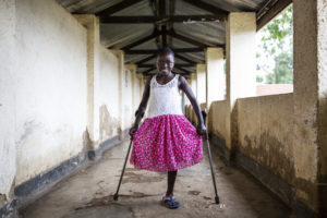Kelvine verlor nach einer Rebellenattacke ein Bein. Viel Unterstützung lässt sie wieder lächelnd nach vorne blicken. Foto: © Patrick Meinhardt / HI 